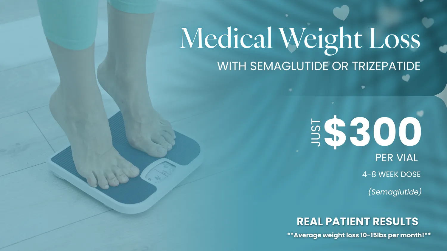 CoolSculpting® special graphic