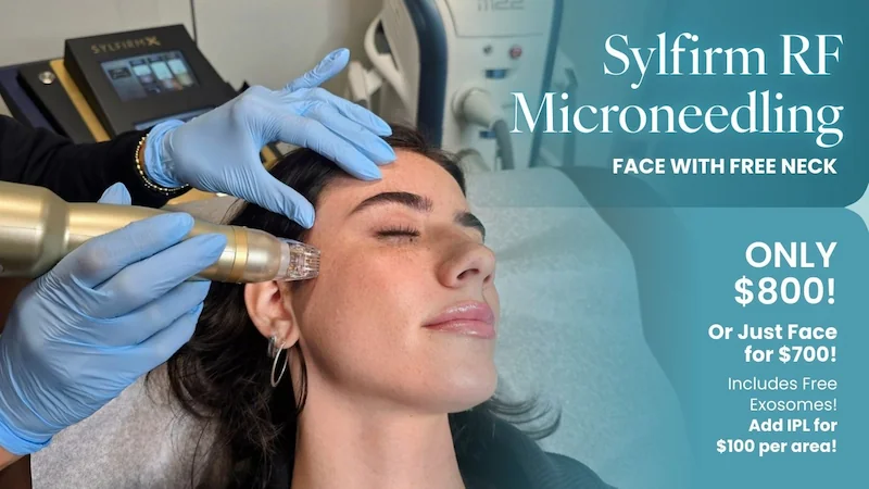 microneedling special graphic
