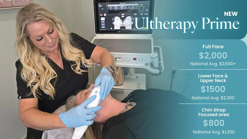 ultherapy special graphic