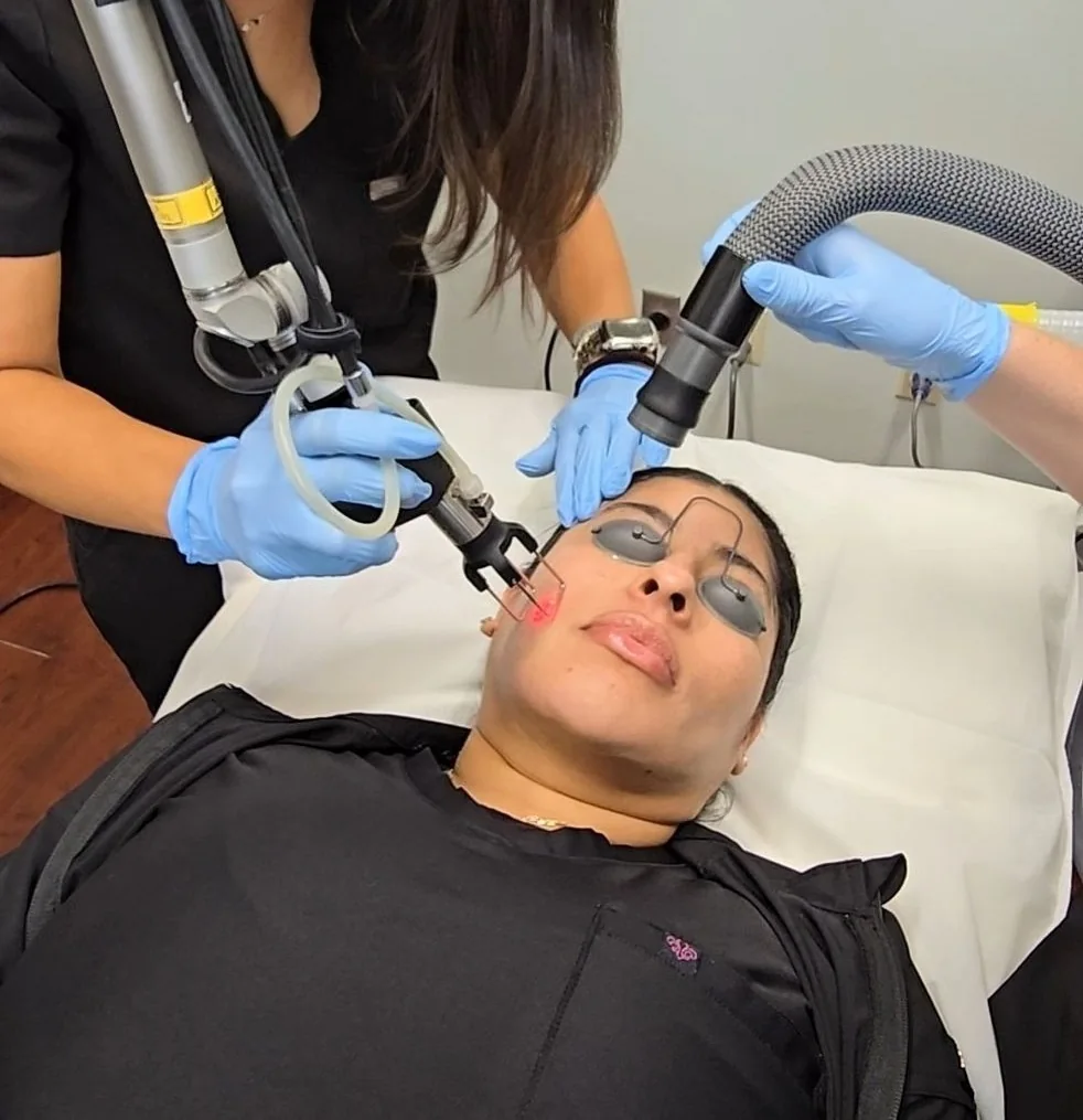 CoolPeel CO2 laser device delivering controlled skin resurfacing treatment