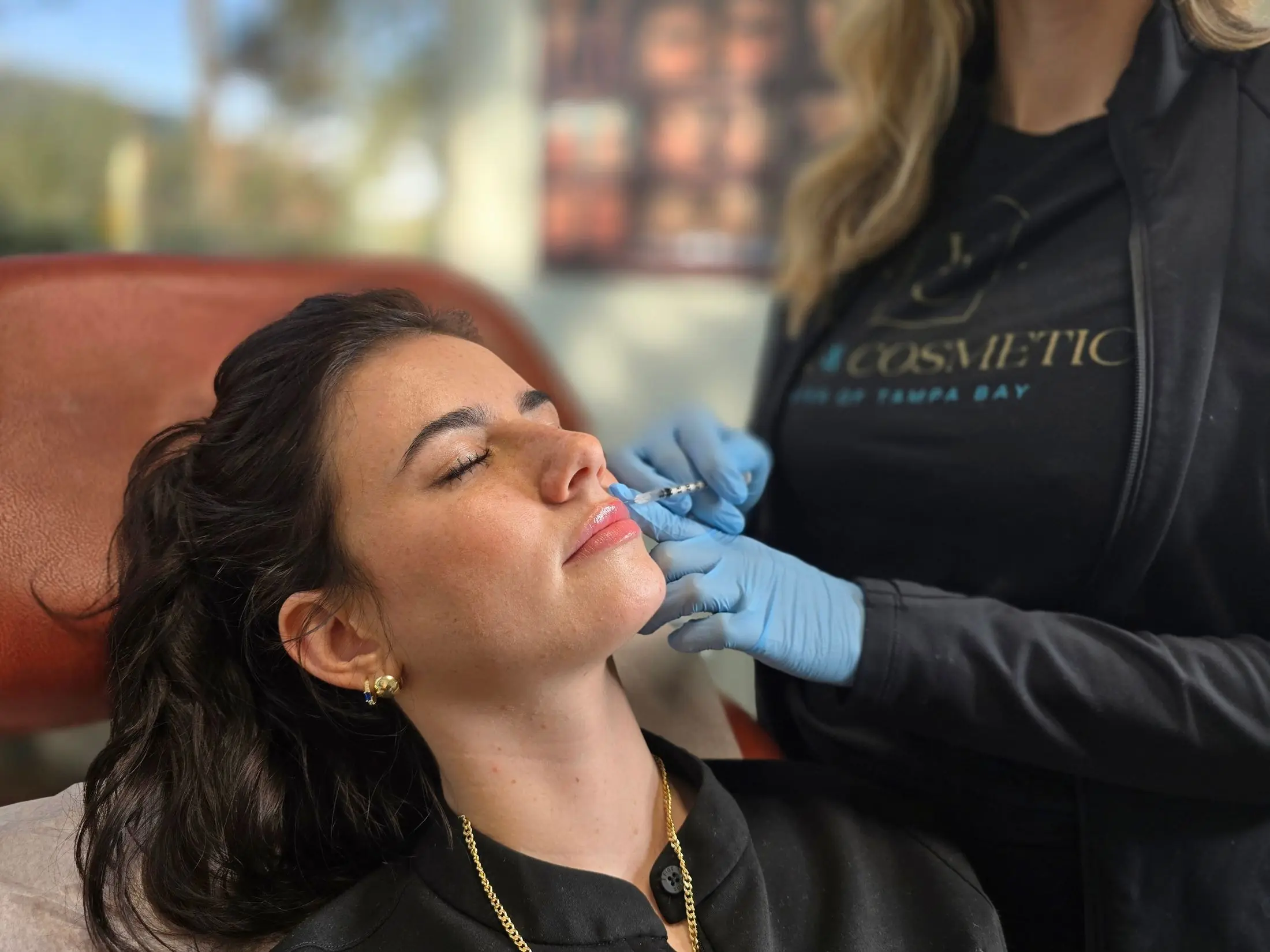 Lip filler injection being administered at Vein & Cosmetic Center