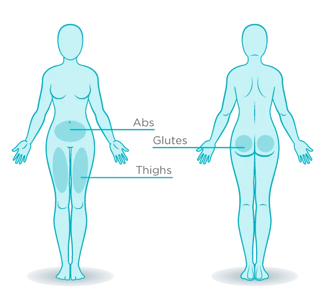 Cooltone treatment areas diagram