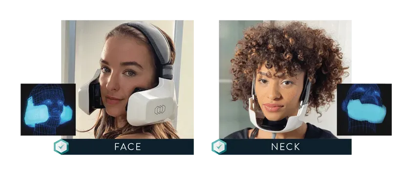 Demonstration of InMode Evoke device in use on face and on neck