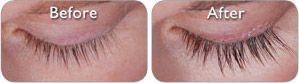Latisse lashes before and after