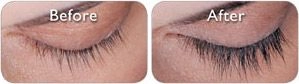 Latisse lashes before and after