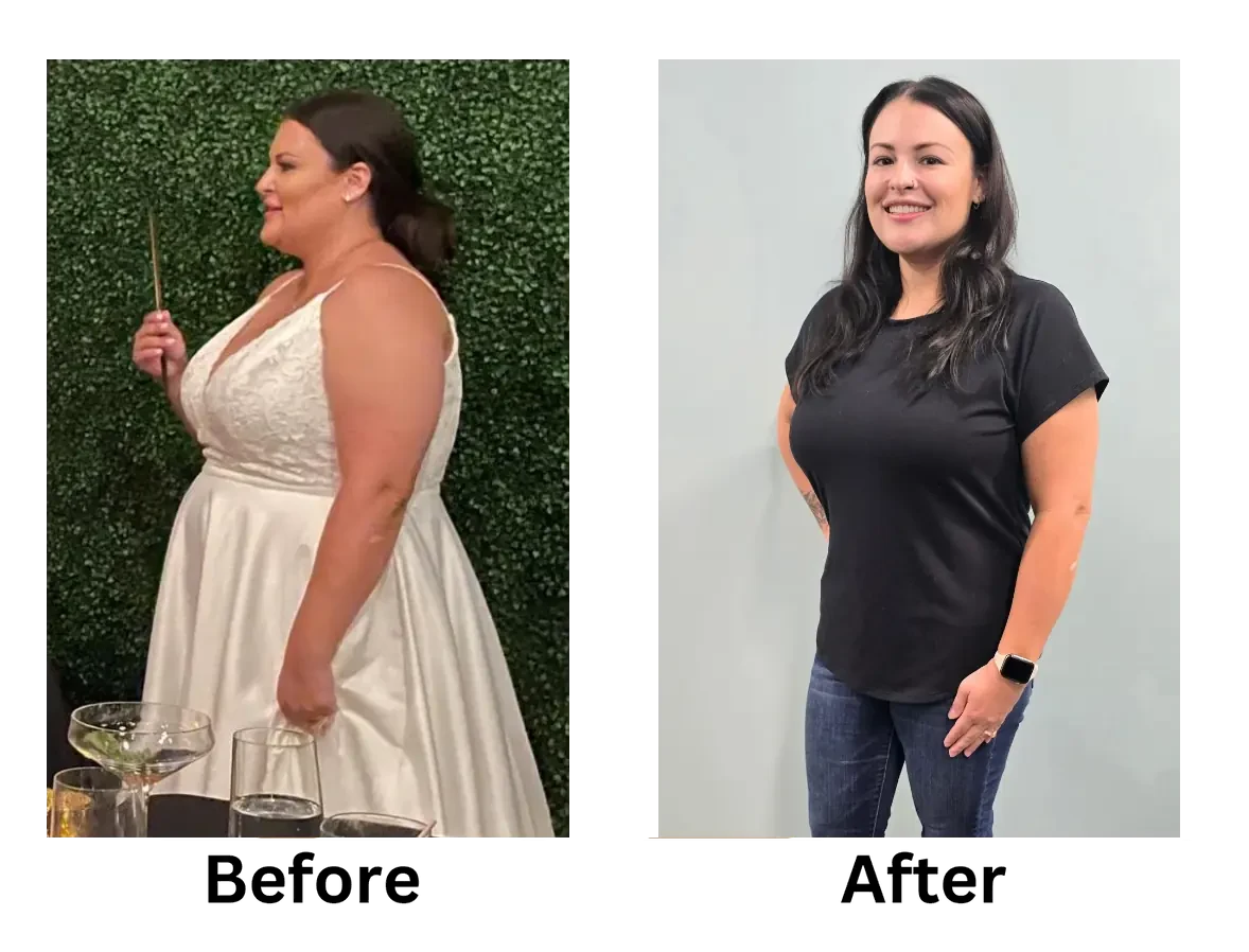 Peptide weight loss patient before and after transformation