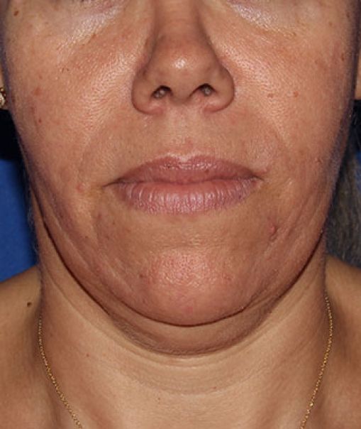 Patient 7 before photo