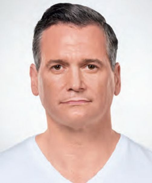 Patient 8 after photo