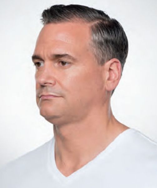  bna image b