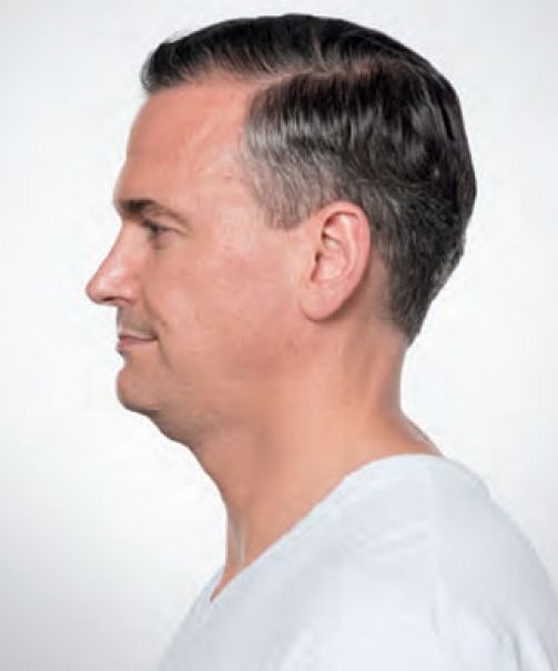  bna image b