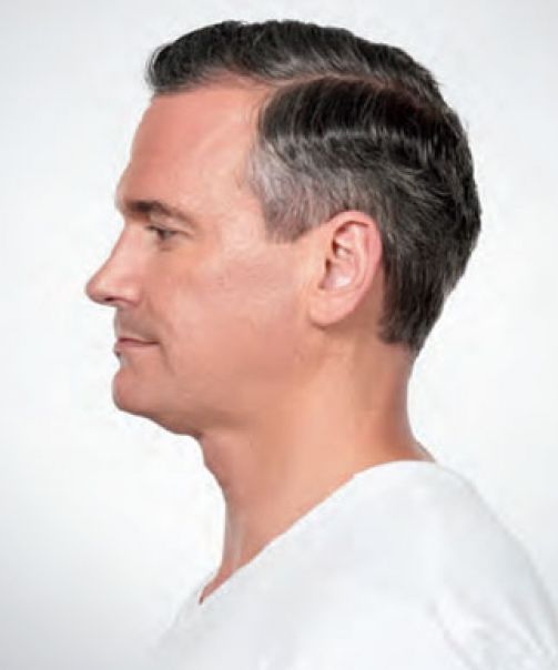 bna image