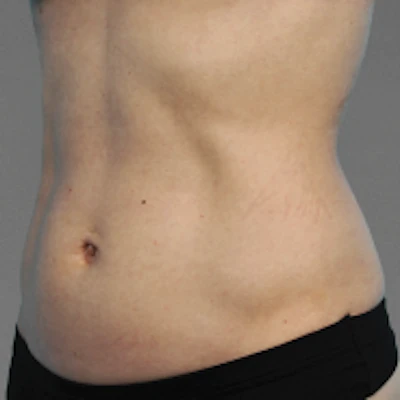 Patient 6 before photo