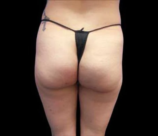 Patient 7 after photo