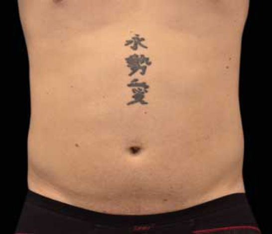 Patient 4 before photo