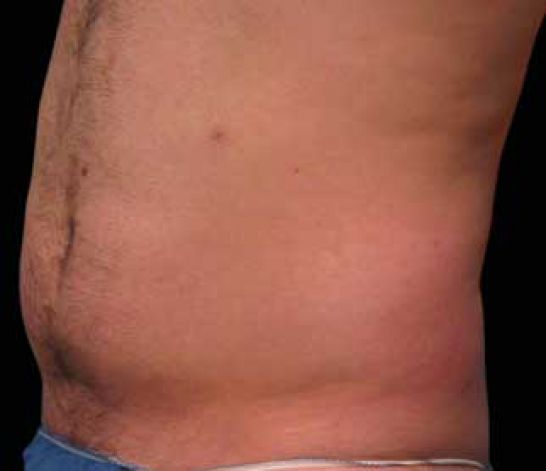 Patient 5 before photo