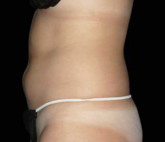 Patient 7 before photo