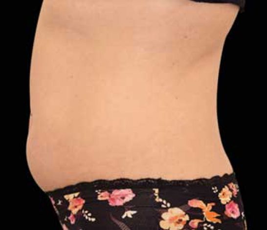 Patient 10 before photo