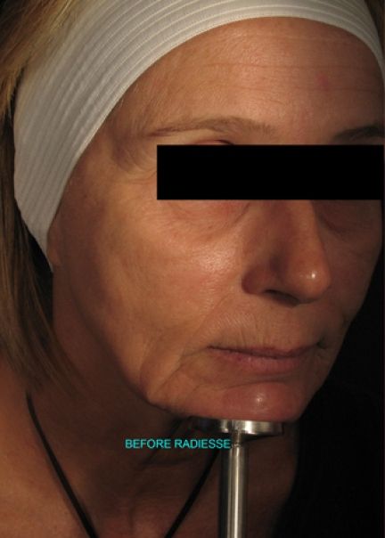Patient 2 before photo