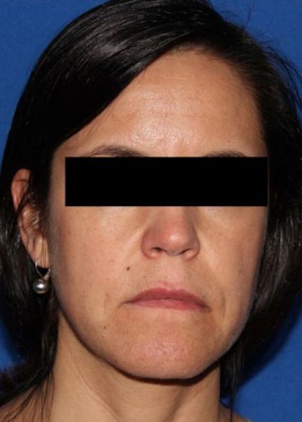 Patient 3 before photo