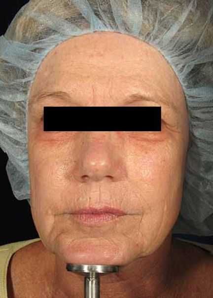 Patient 7 before photo