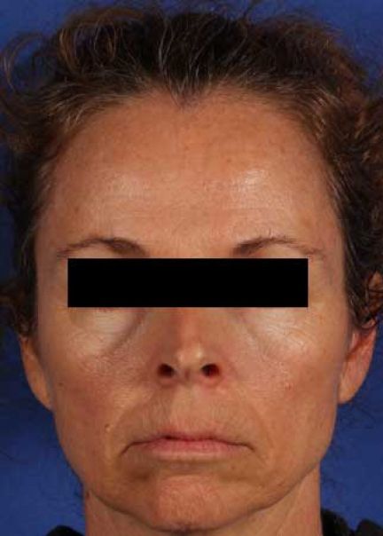 Patient 8 before photo