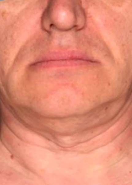  bna image b