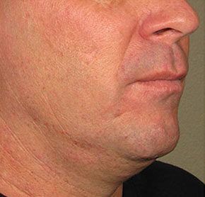 Patient 4 before photo