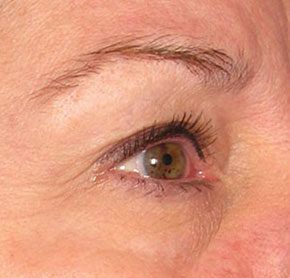Patient 7 before photo