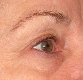 Patient 7 after photo