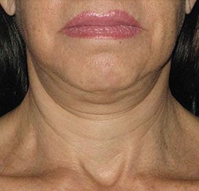 Patient 8 before photo