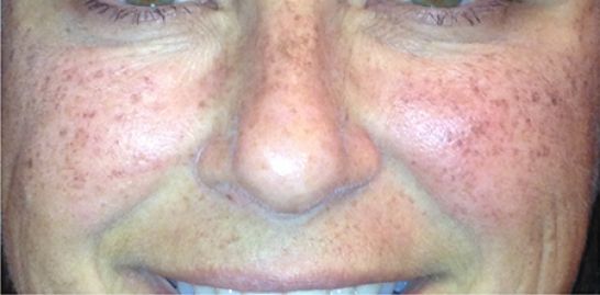 Patient 2 before photo