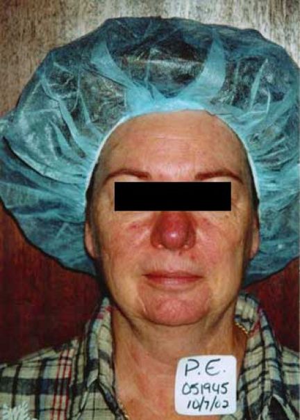 Patient 3 before photo