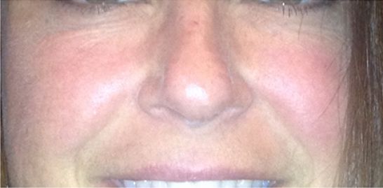Patient 2 after photo